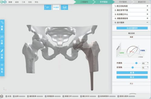 3d打印人體骨骼 這家哈佛大學(xué)孵化的公司要為中國(guó)醫(yī)生開發(fā)自己的軟件平臺(tái)...